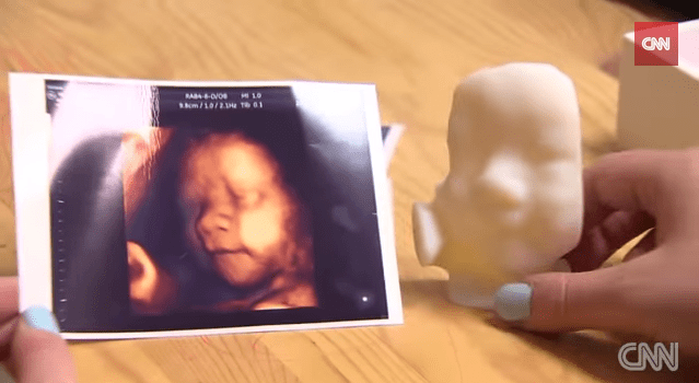 20150203tu-cnn-get-a-3d-print-of-your-unborn-baby-20130716